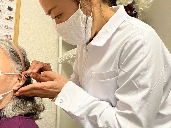 耳ツボダイエット施術の様子