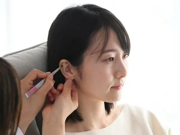 耳ツボダイエット施術の様子