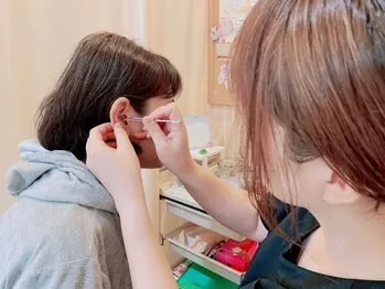 耳ツボダイエット施術の様子
