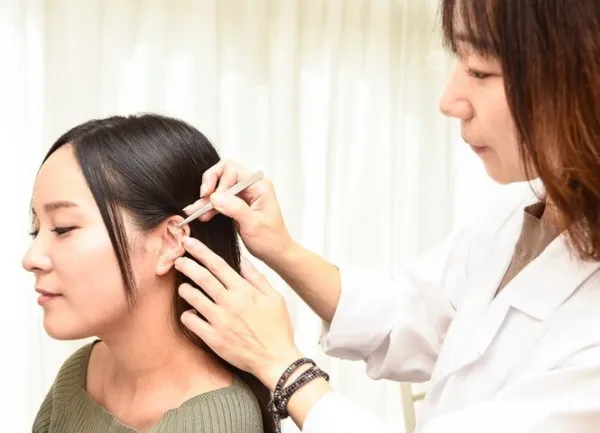 耳ツボダイエット施術の様子
